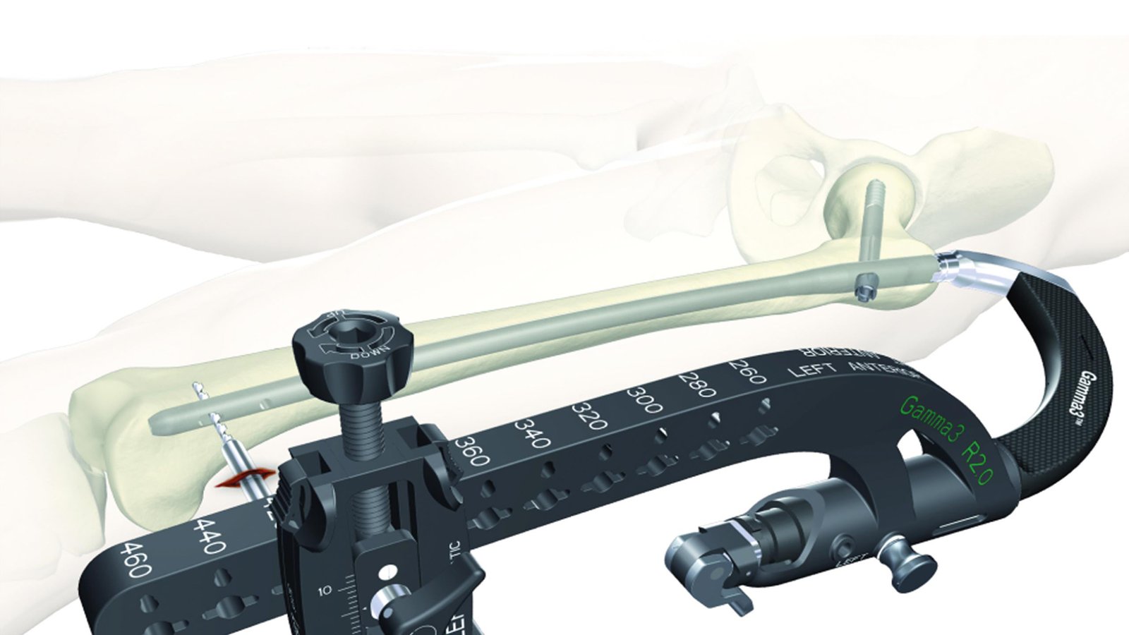 startseite | stryker deutschland